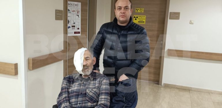 Boyabat Kaymakamlığı ve Boyabat Belediyesi yüzü eriyen hasta için harekete geçti…